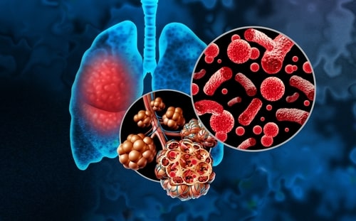 How Mold Affects the Respiratory System